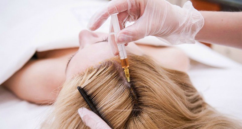 фото процедуры лечения выпадения волос у женщин