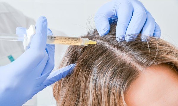 лечебный коктейль при мезотерапии волос