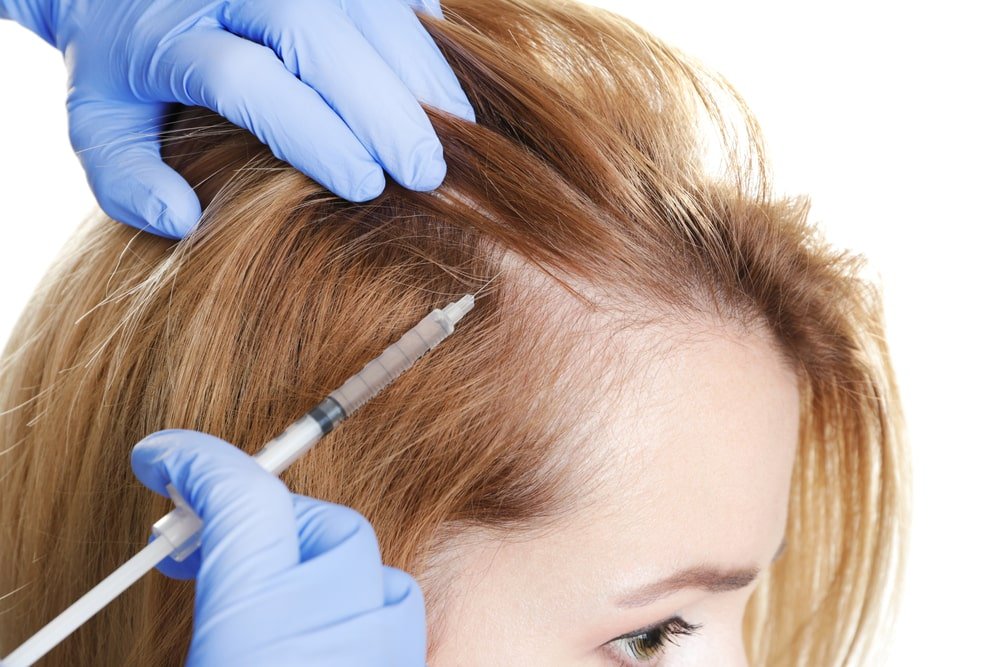 вкалывание лечебного коктейля при мезотерапии волос