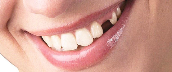Причины для обращения к стоматологу-ортопеду