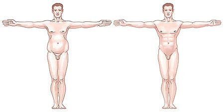 фото до и после проведения удаления жировых отложений у мужчин