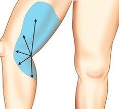 область колена для проведения липосакции