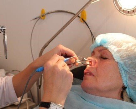 проведение операции по септопластике носовой перегородки