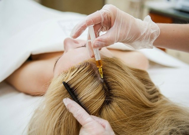 процедура проведения PRP для волос