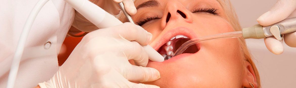 Что такое глубокий кариес?