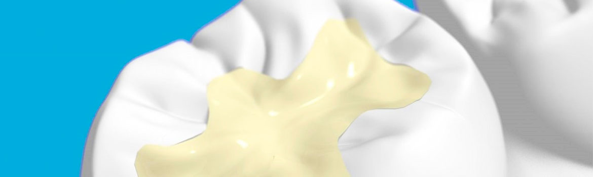 Что делать, если выпала временная пломба?