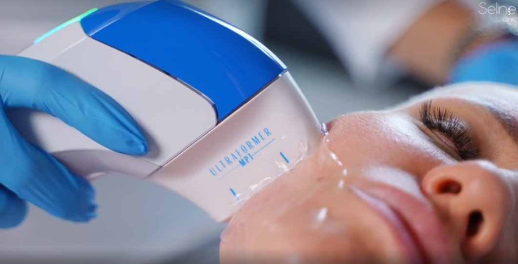 Скидка 20% на SMAS-лифтинг Ultraformer MPT (от 300 линий)