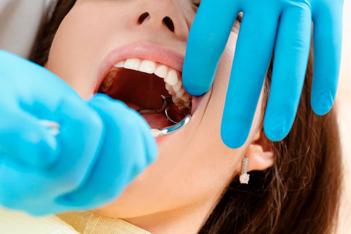 Чего нельзя делать после удаления зуба мудрости?