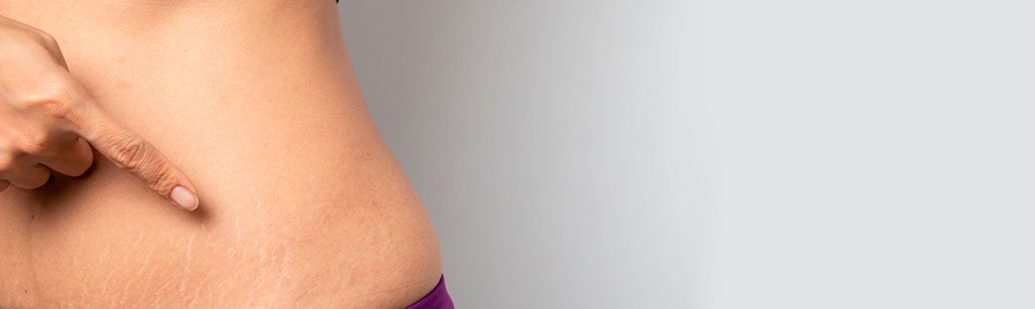 Обвисла кожа после похудения — что делать?