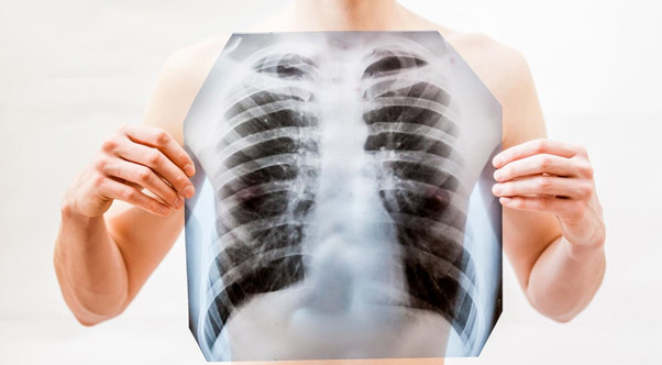 Восстановление после ковида