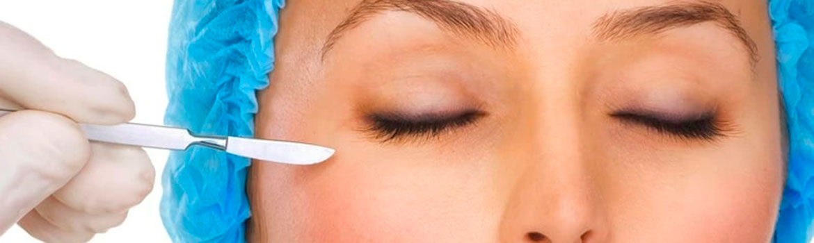  Как делают блефаропластику