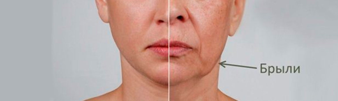 Как убрать брыли на лице