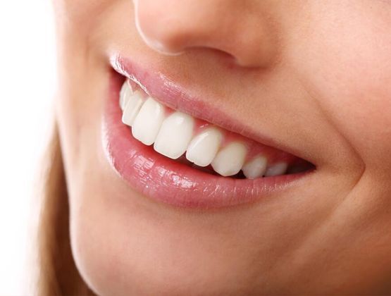 Керамические виниры