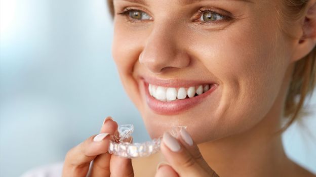 Элайнеры: отличный способ исправления прикуса