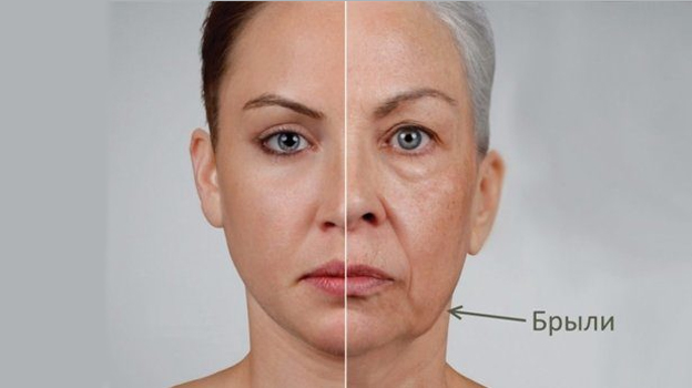 Как убрать брыли на лице