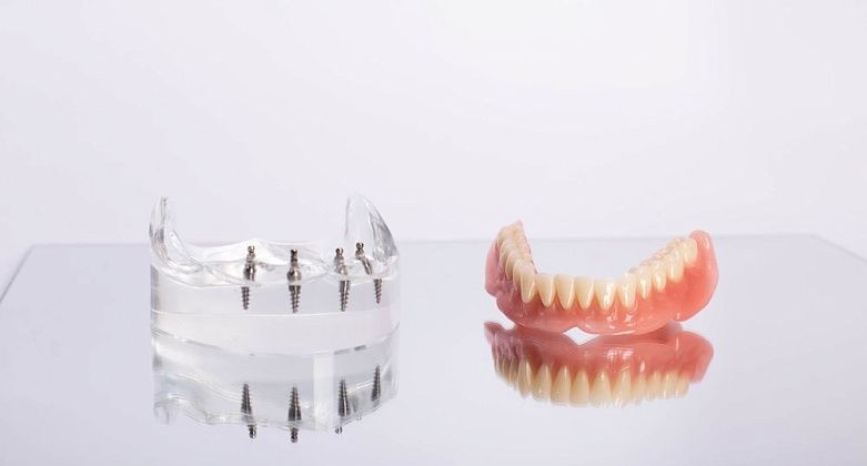 Протезирование зубов