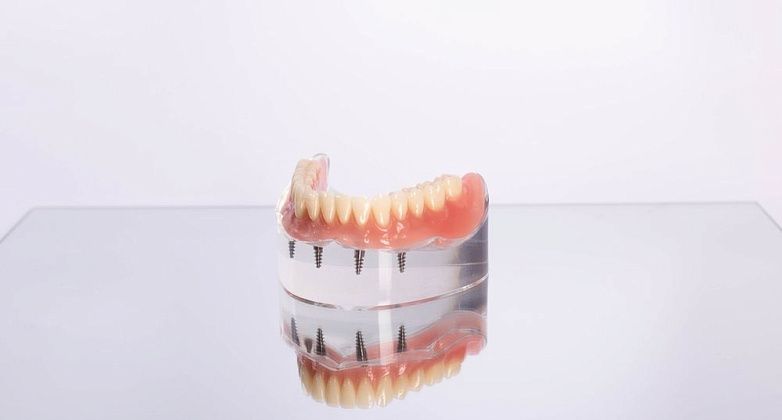 Несъемное протезирование