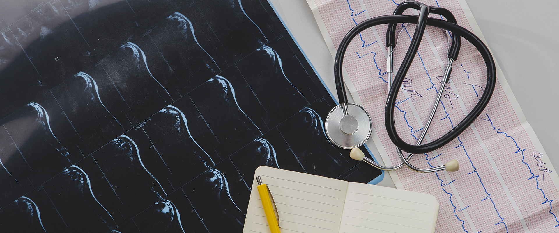 Суточное мониторирование артериального давления (СМАД)