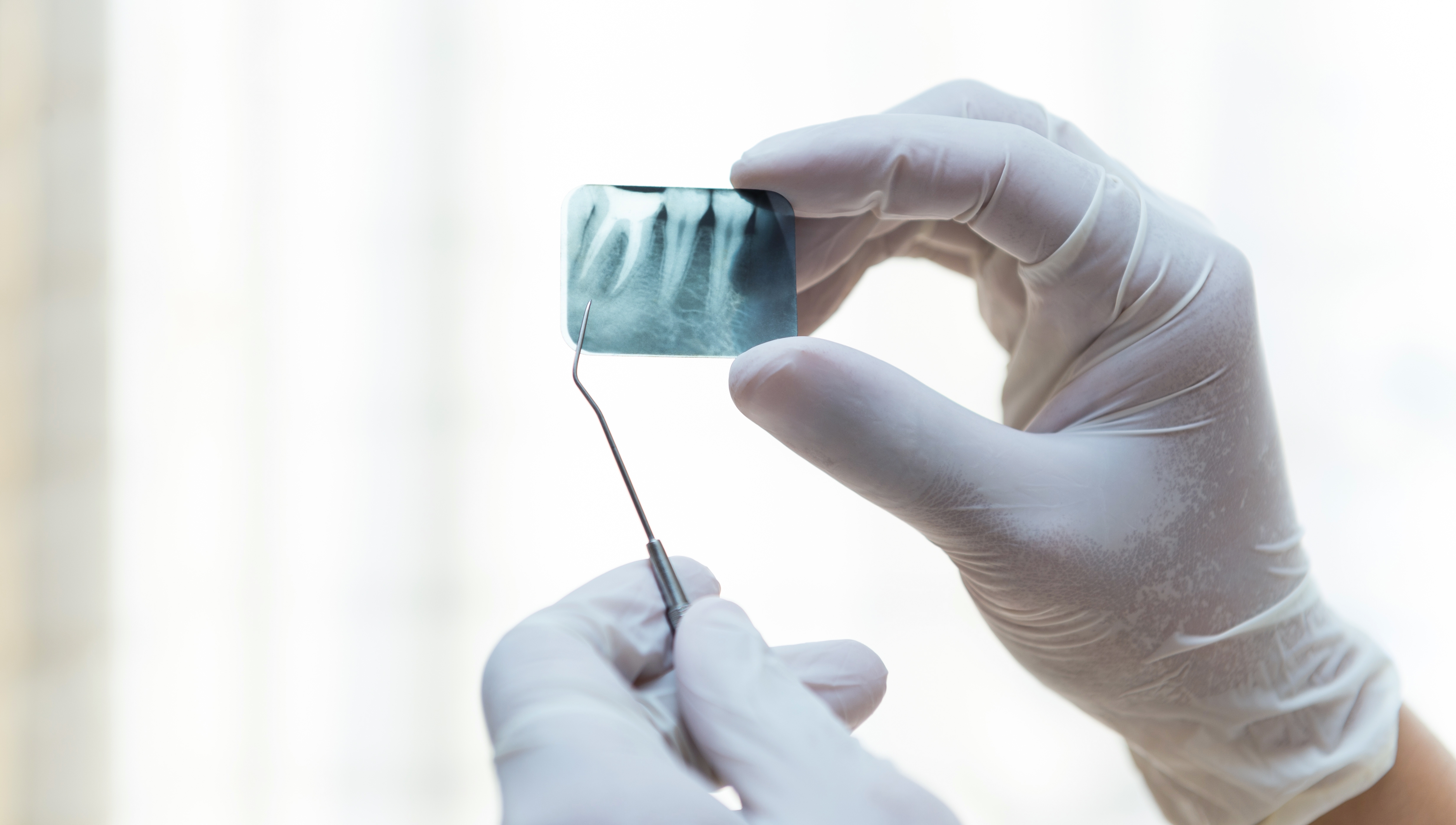 Обнажение коронки ретинированного зуба