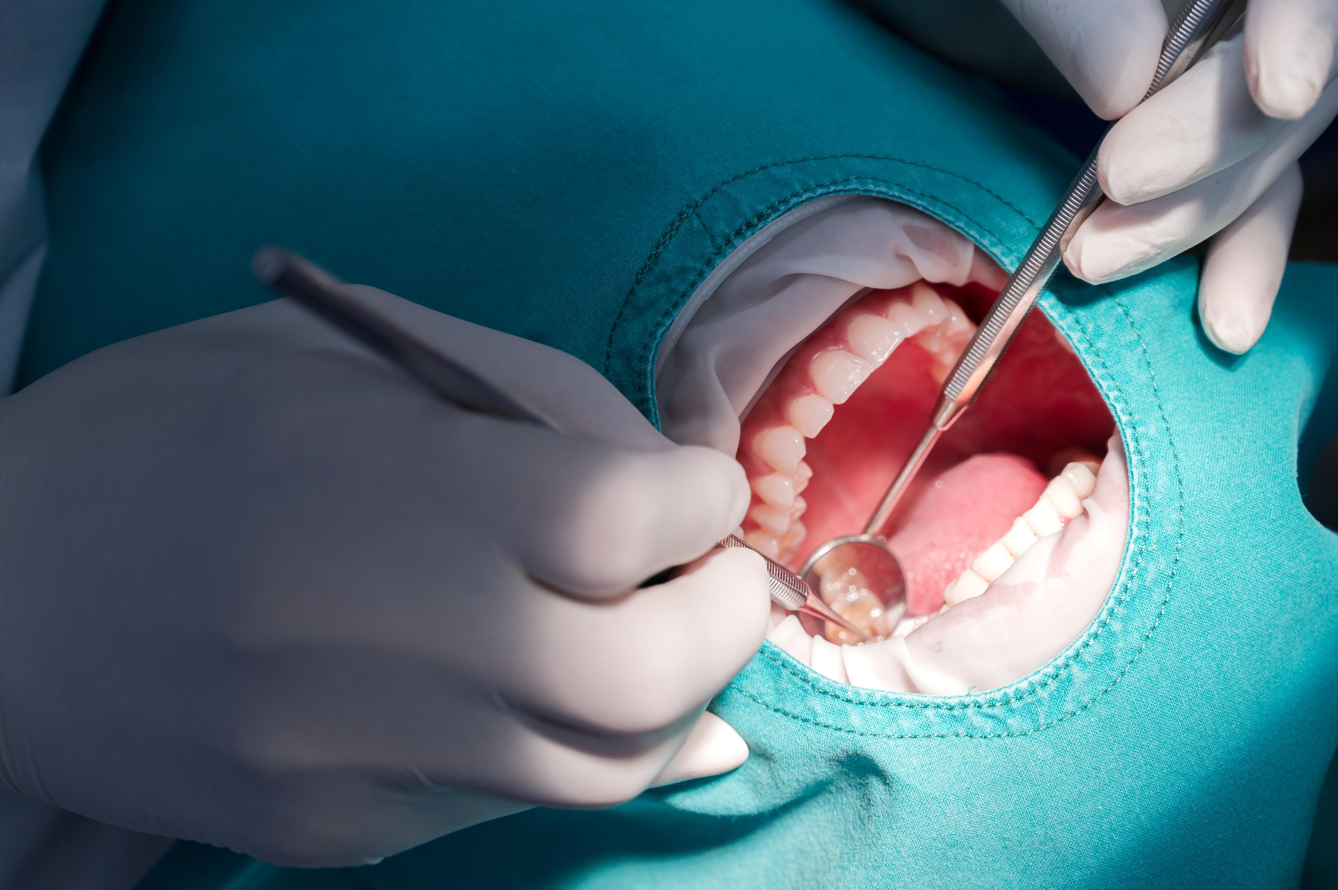 Синус-лифтинг