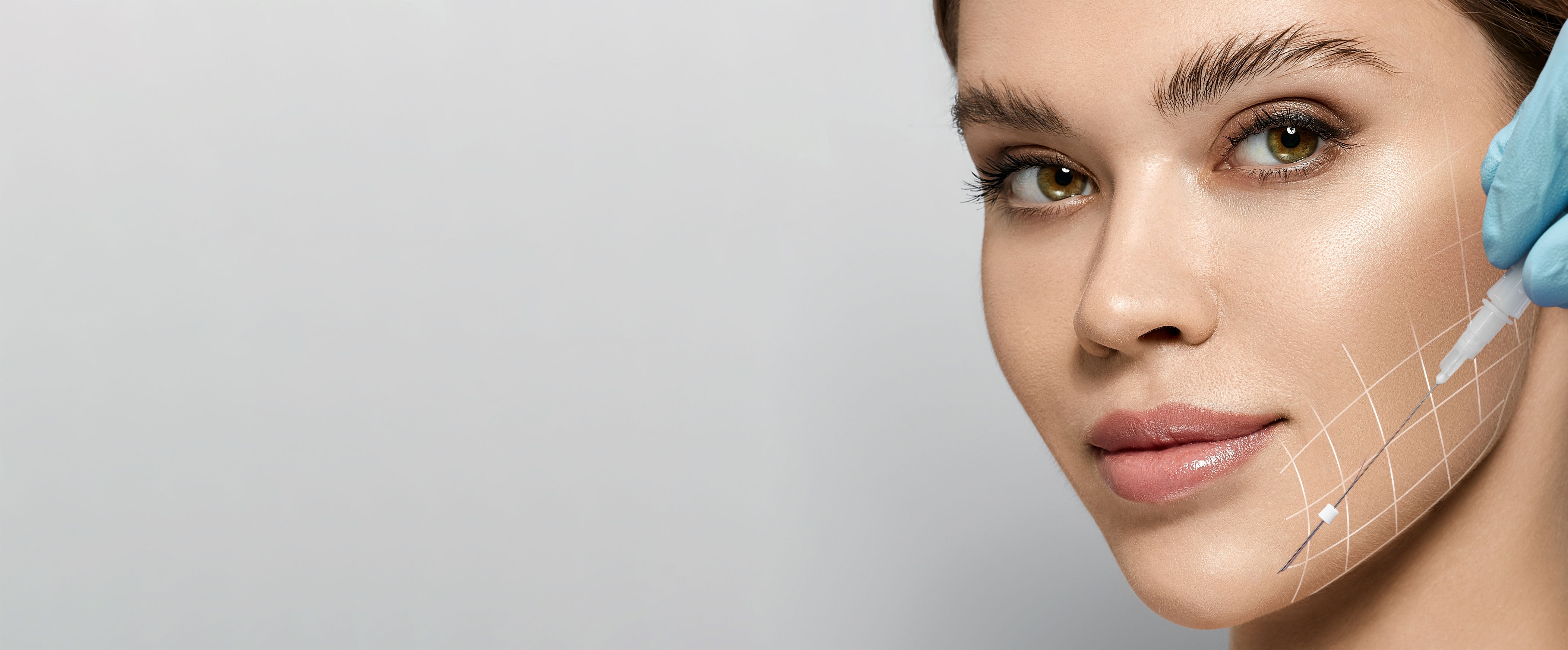 Нитевой лифтинг